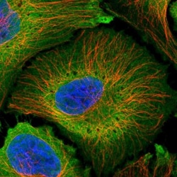 PLCD4 Antibody, Novus Biologicals 0.1mL; Unlabeled:Antibodies, Polyclonal